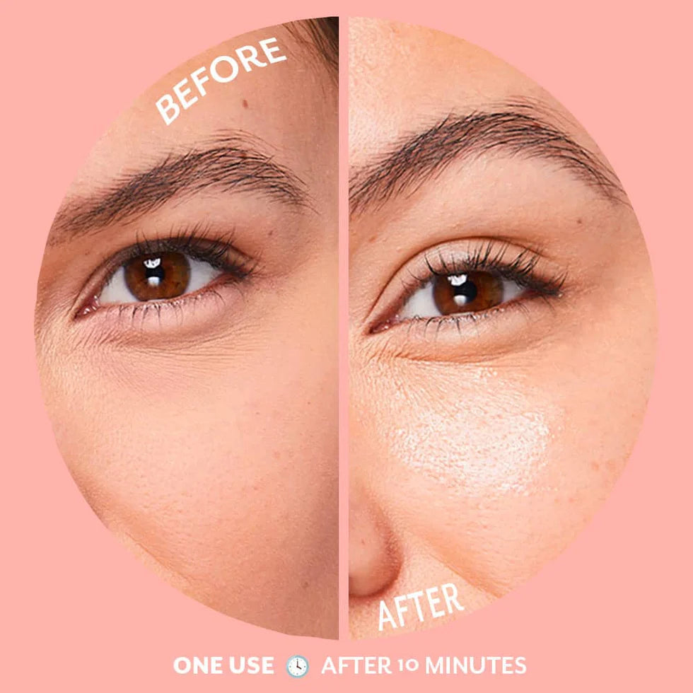 Patchology - Bubbly Serve Chilled™ Brightening Eye Gels - 5 Pairs